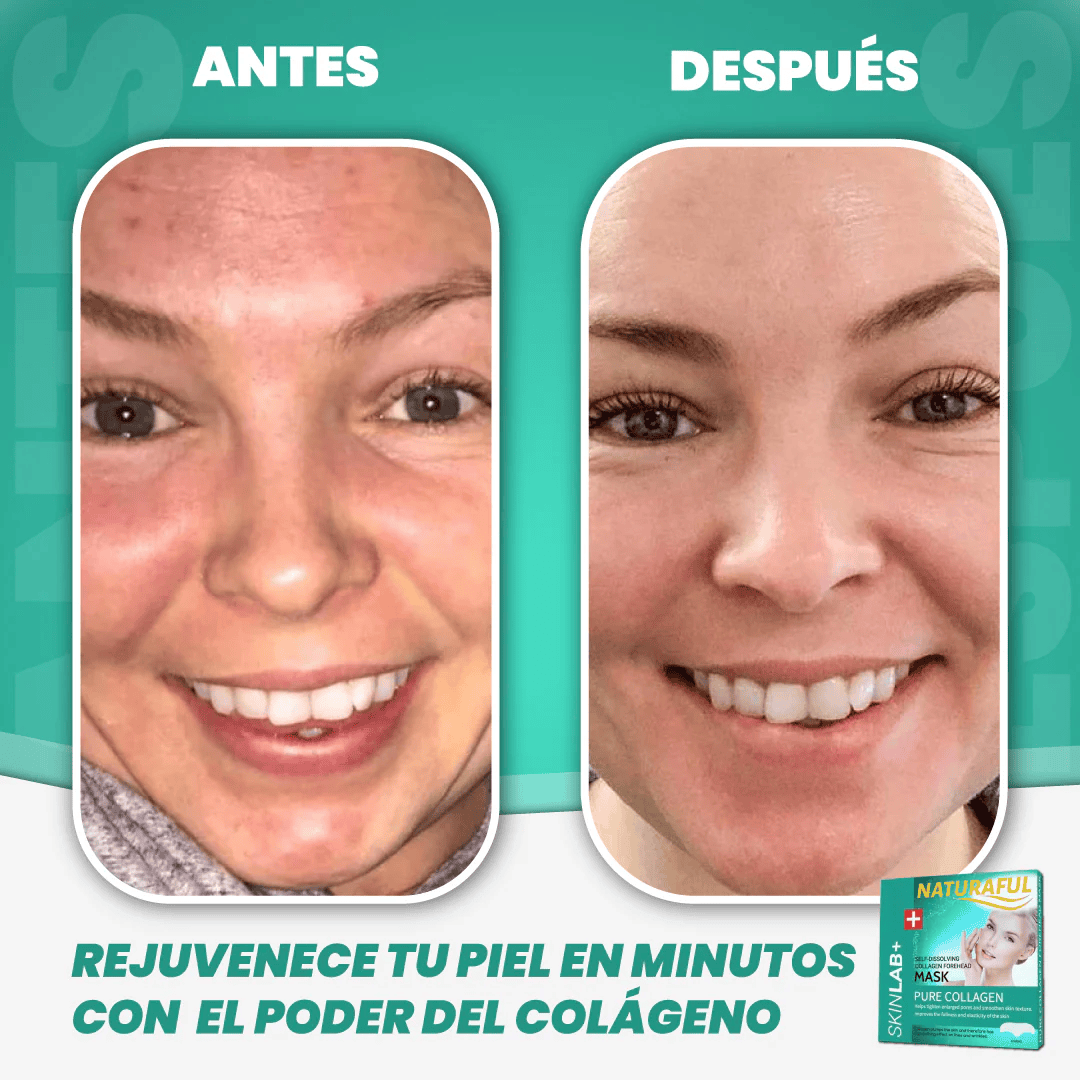 Parches Colágeno Ultra Absorventes Naturaful (2x1)