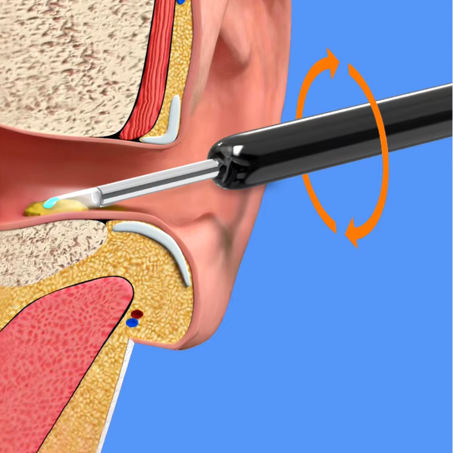 EarClean - LIMPIADOR DE OIDOS CON CÁMARA